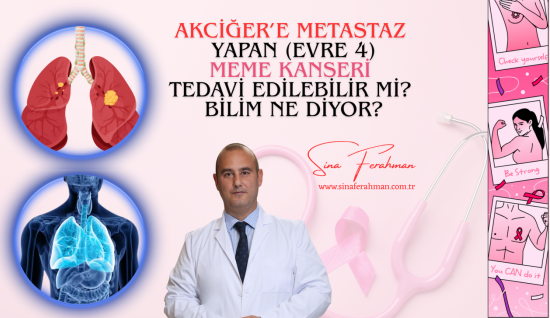 Meme Kanseri Akciğere Sıçradığında Ne Olur? Tedavi Mümkün mü? Bilim Ne Diyor?