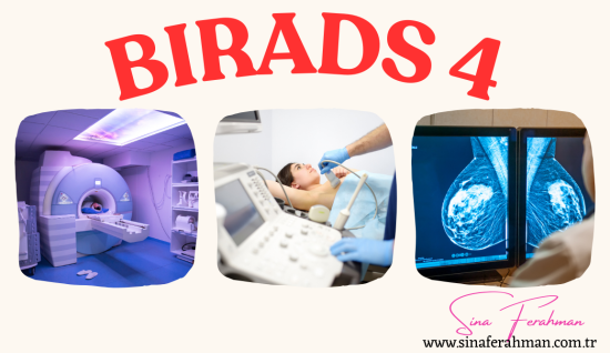 BI-RADS 4 nedir, ne demek, ne anlama gelir? 4A – 4B – 4C ile Değerlendirme. 2025 Kılavuzu