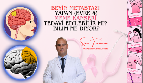 Meme Kanseri Beyin Metastazı Tedavi Edilebilir mi? Bilim Ne Diyor?