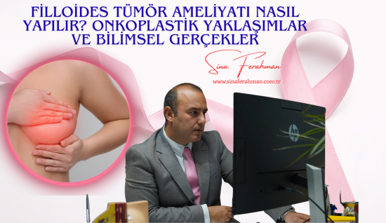 Filloides Tümör Ameliyatı Nasıl Yapılır? Onkoplastik Yaklaşımlar ve Bilimsel Gerçekler
