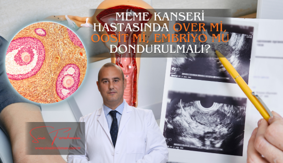 Meme Kanseri Hastasında Yumurta Dondurma: Over mi, Oosit mi, Embriyo mu Dondurulmalı? Bilimsel Rehber