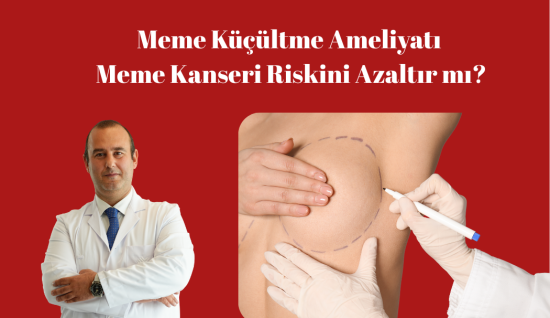 Meme Küçültme Ameliyatı Meme Kanseri Riskini Azaltır mı? Bilimsel Gerçekler