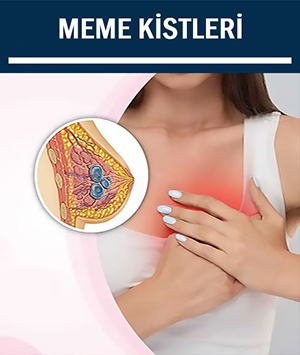 Meme Kistleri